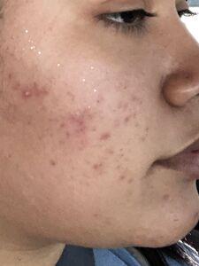 Liltriste Bbytriste Heiße Fotos Tristeluna Tristebby XXX